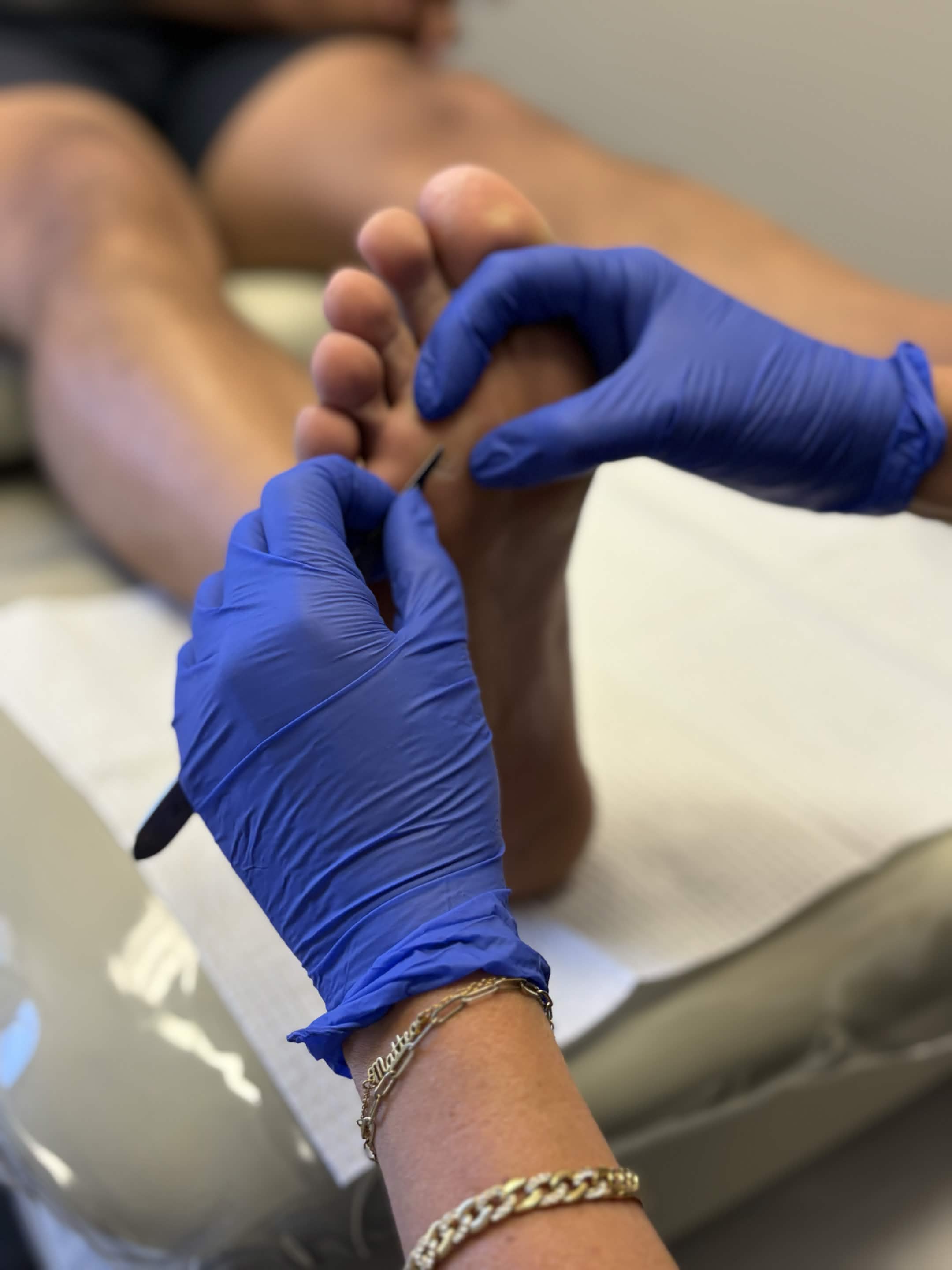Warts and fungus treatment